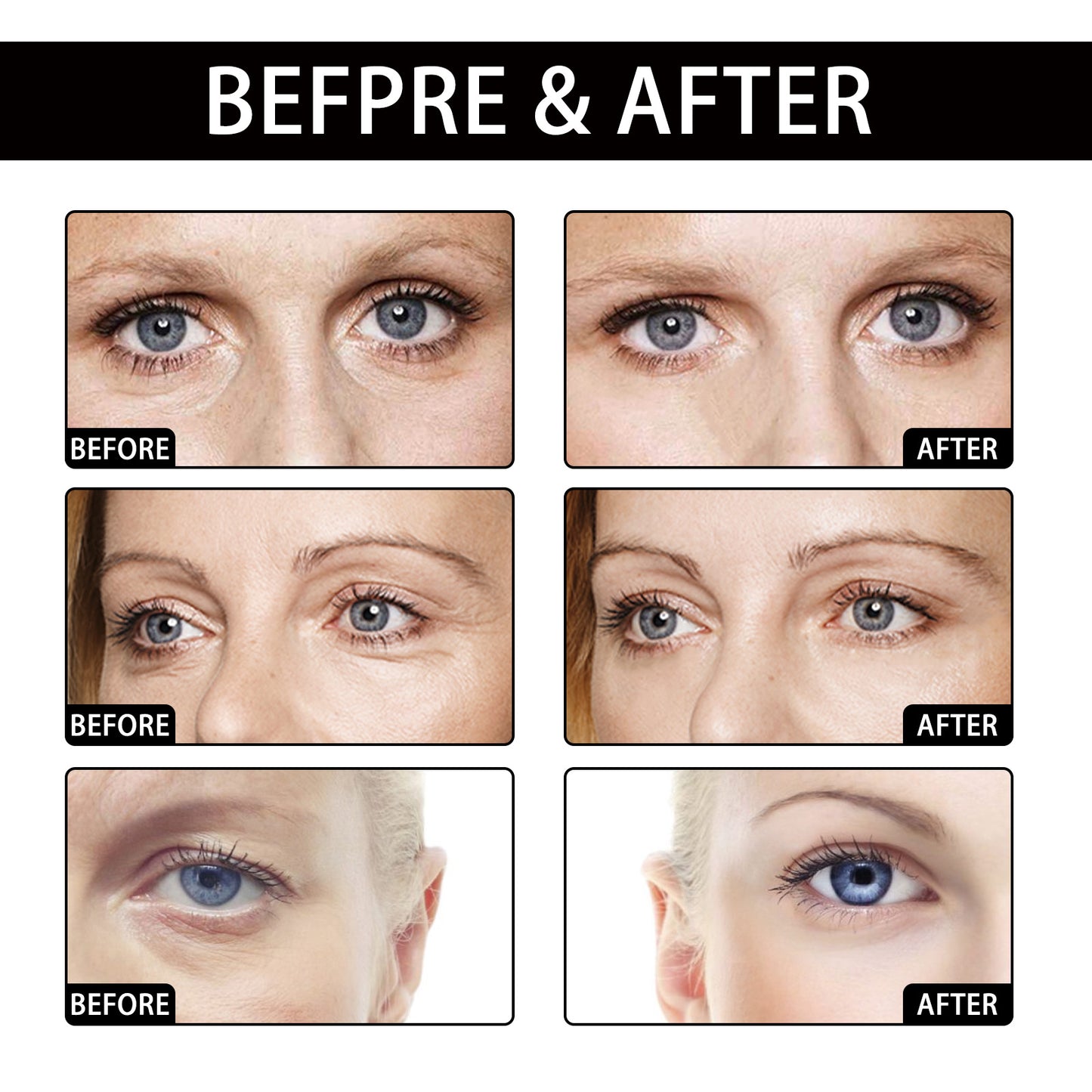 Hoygi Coconut Eye Gel Patches – Hydrating, Anti-Wrinkle & Brightening Under-Eye Care